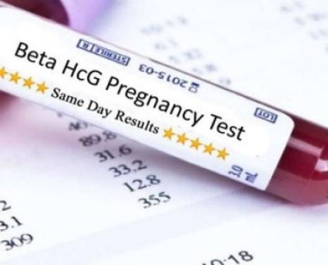 Ý nghĩa chỉ số xét nghiệm beta HCG là gì? 