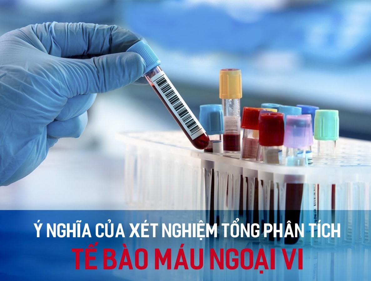 Ý nghĩa xét nghiệm tổng phân tích tế bào máu