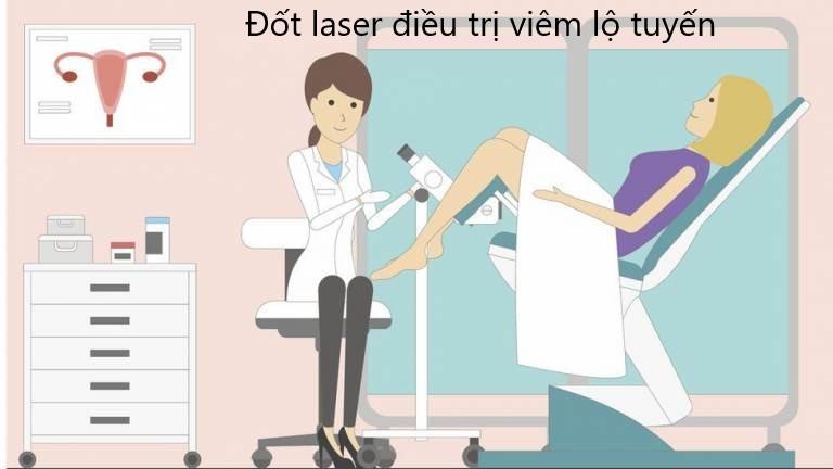 Ưu điểm đốt laser điều trị viêm lộ tuyến cổ tử cung