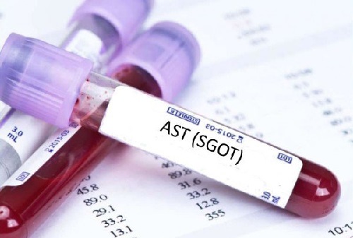 Chỉ số AST (SGOT) có ý nghĩa gì trong xét nghiệm máu
