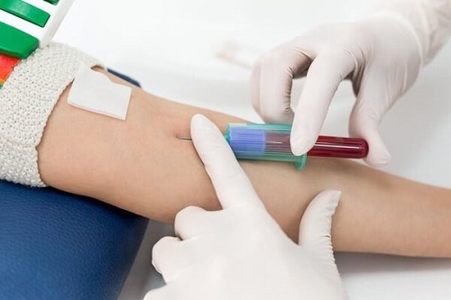 Chỉ số xét nghiệm máu MCV là gì?