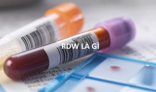 Ý nghĩa của chỉ số RDW trong xét nghiệm máu