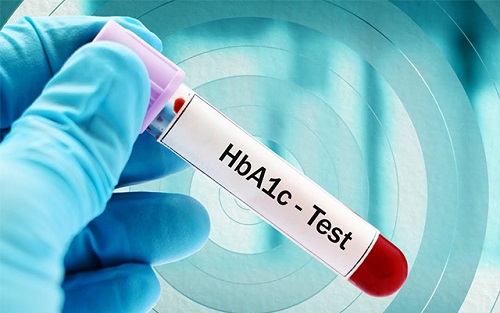 Cần lưu ý gì khi thực hiện xét nghiệm HbA1c không?