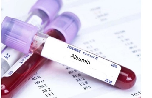 Lưu ý khi thực hiện xét nghiệm Albumin bạn cần biết