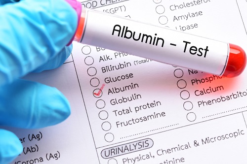 Ý nghĩa của chỉ số Albumin trong xét nghiệm máu