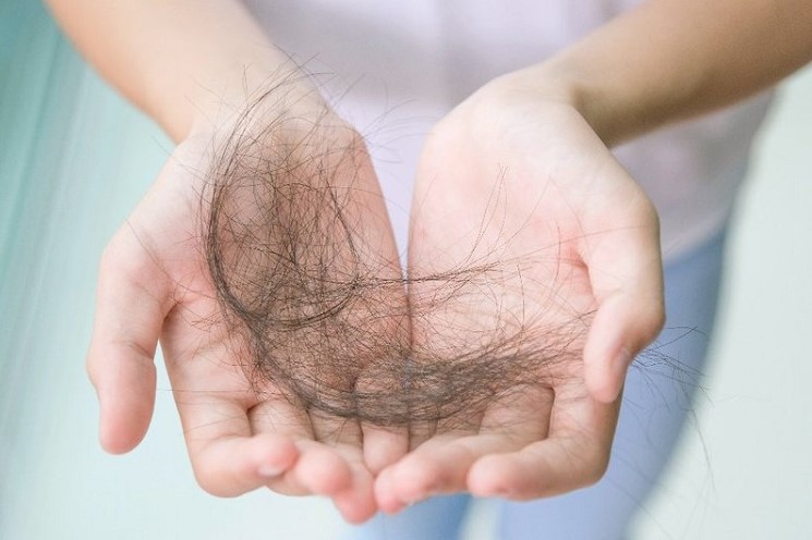 Rụng tóc là 1 trong những triệu chứng khi thiếu kẽm
