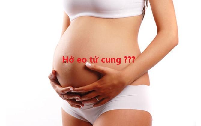 Hở eo tử cung khi mang thai có nguy hiểm không?