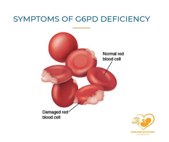 Người mắc bệnh thiếu men G6PD sẽ biểu hiện như thế nào?