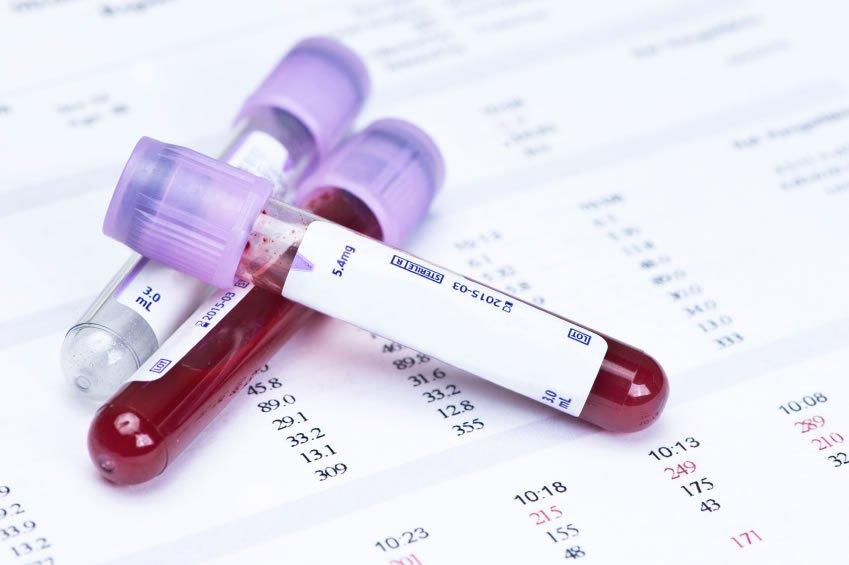 Chỉ số RBC trong xét nghiệm máu là gì?