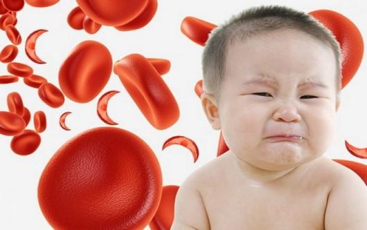 Thiếu máu thiếu sắt ở trẻ nhỏ