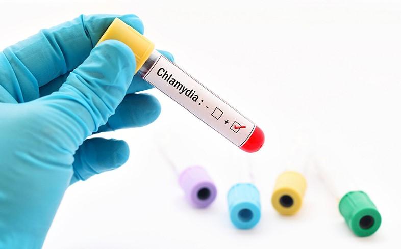 Xét nghiệm Chlamydia và những điều cần biết?