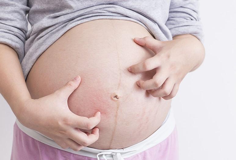 Dị ứng ngoài da trong thai kỳ