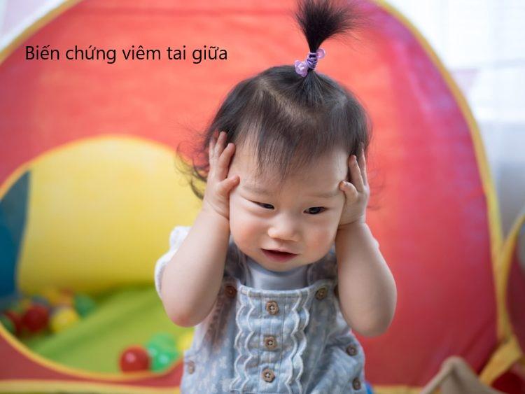 Biến chứng viêm tai giữa ở trẻ em
