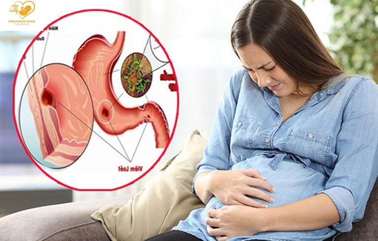 Đau dạ dày ở phụ nữ mang thai có ảnh hưởng như thế nào?