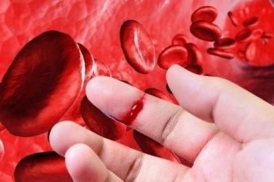 Bệnh máu khó đông (Hemophilia) là gì và cách điều trị.