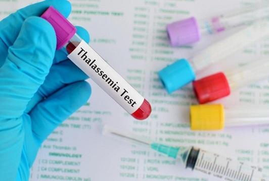 Sàng lọc bệnh Thalassemia: Bước đầu tiên quan trọng không thể bỏ qua