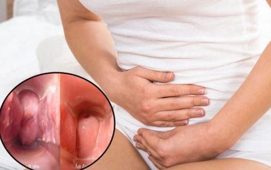 Cảnh báo: Viêm nhiễm phụ khoa- kẻ thù giấu mặt của phụ nữ