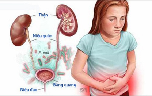 Khi mang thai bị viêm tiết niệu thì phải làm sao?