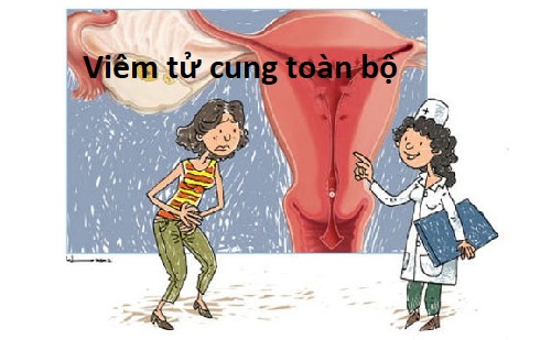 Viêm tử cung toàn bộ – Nguyên nhân, triệu chứng và cách điều trị?