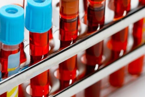 Tại sao cần xét nghiệm nhóm máu Rh với phụ nữ mang thai