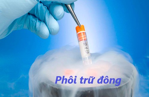 Phôi đông lạnh -Những điều bạn cần biết