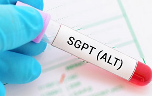 Chỉ số ALT (SGPT) có ý nghĩa gì trong xét nghiệm máu