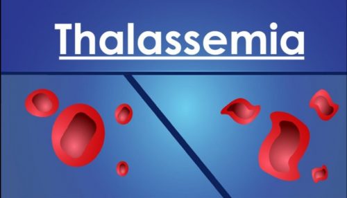 Bệnh thalassemia có chữa được không?