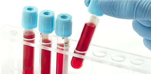 Xét nghiệm nhóm máu có cần nhịn ăn không?