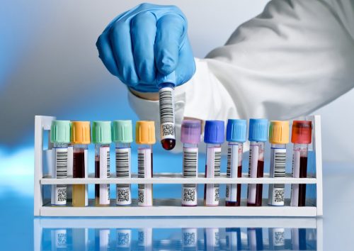 Chỉ số xét nghiệm HGB trong máu có ý nghĩa gì?