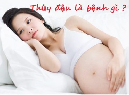 Bệnh thủy đậu và những câu hỏi liên quan đến thai kỳ