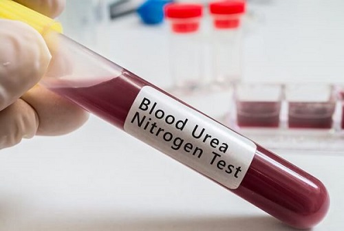 Xét nghiệm Ure máu tăng cao nguy hiểm như thế nào tới cơ thể