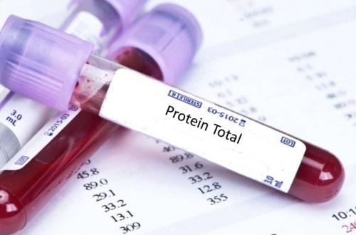 Định lượng Protein toàn phần thay đổi trong trường hợp nào?