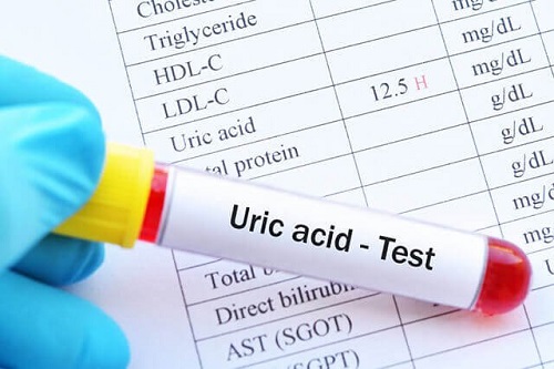 Nguyên nhân và triệu chứng của Acid uric máu tăng