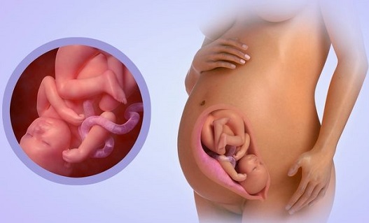 Các chỉ số đánh giá thai chậm phát triển trong tử cung