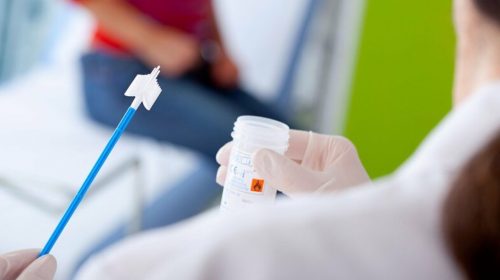 Kết quả xét nghiệm Pap smear phản ánh điều gì?