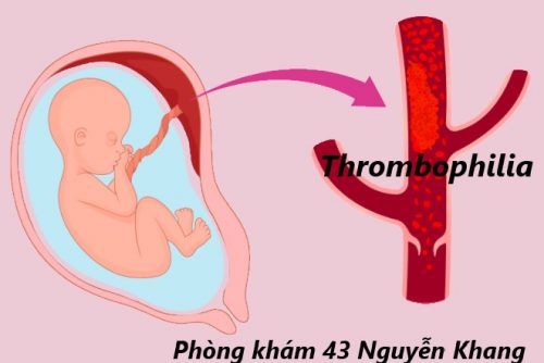 Thrombophilia – Hội chứng tăng đông