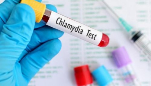 Khi nào cần thực hiện xét nghiệm chlamydia?