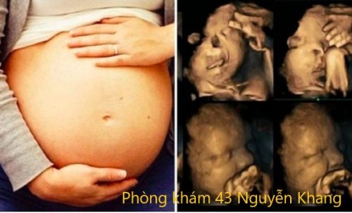 7 dị tật bẩm sinh thường gặp ở thai nhi