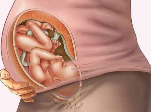 3 kiểu ngôi thai bất thường hay gặp trong thai kỳ