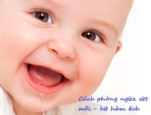 Cách phòng ngừa dị tật sứt môi hở hàm ếch