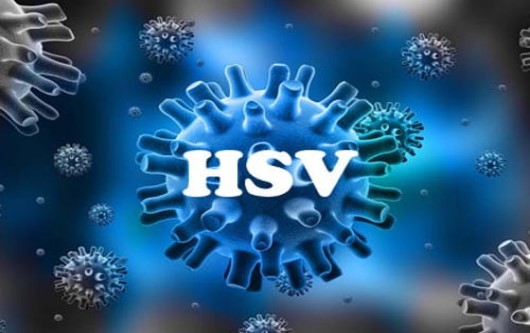 Virus herpes HSV là gì?