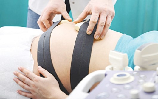 VÌ sao đo monitoring là chỉ định bắt buộc trong thai kỳ?