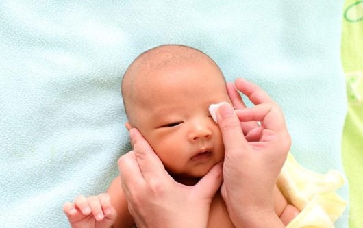 Cách chăm sóc mắt cho trẻ sơ sinh
