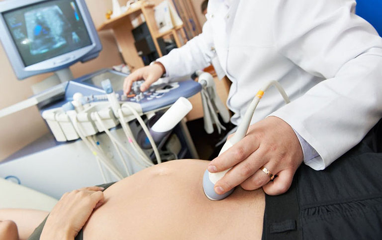 Buồng trứng đa nang gây khó thụ thai vô sinh hiếm muộn 