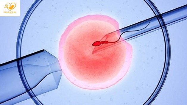 ivf