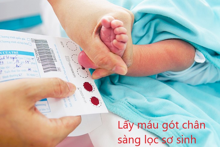 sàng lọc sơ sinh