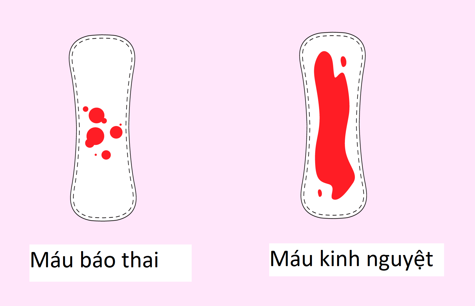 máu báo thai, ra máu, mang thai