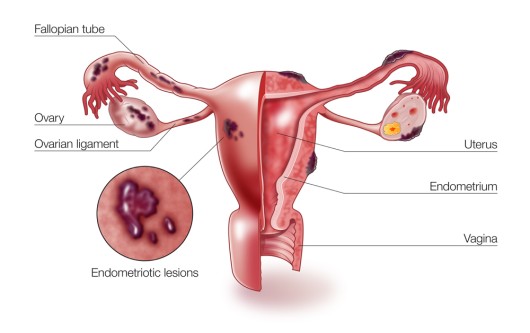 vô sinh hiếm muộn, nguyên nhân khó thụ thai, nguyên nhân khó mang thai tự nhiên, khó thụ thai, yếu tố ảnh hưởng đến khả năng sinh sản