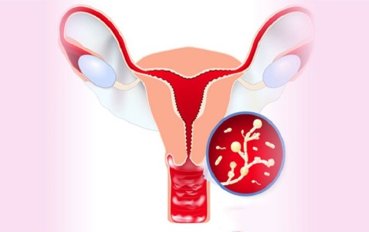Tầm soát chlamydia trachomatis ở phụ nữ mang thai