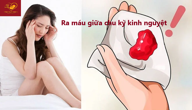 ra máu bất thường